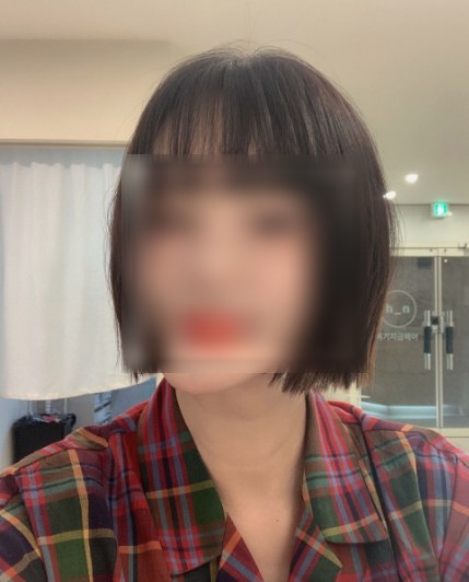 허이현 원장이 시술한 테슬컷 단발